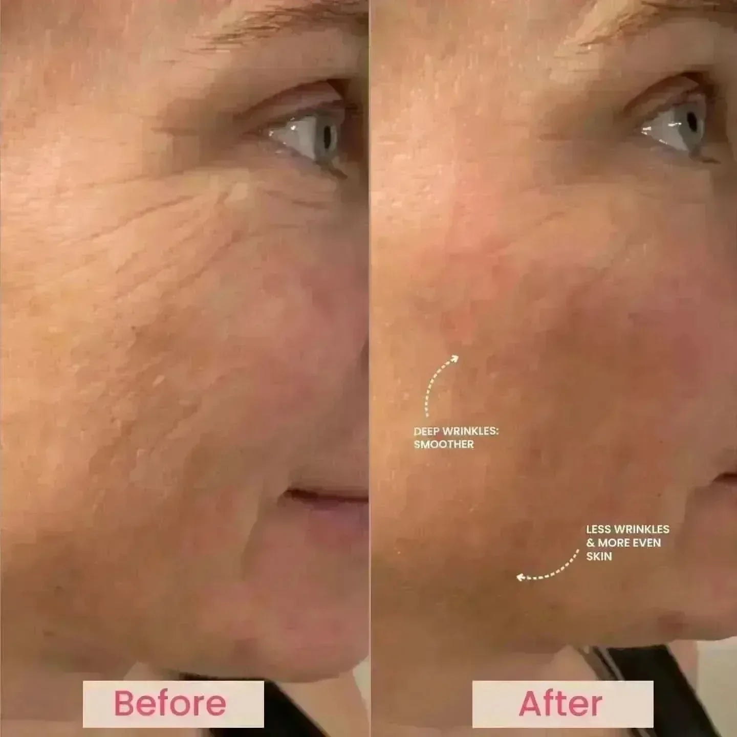 Lumo⁺ + Mirage + Venus: Complete Anti-Aging and Skin Rejuvenation Set