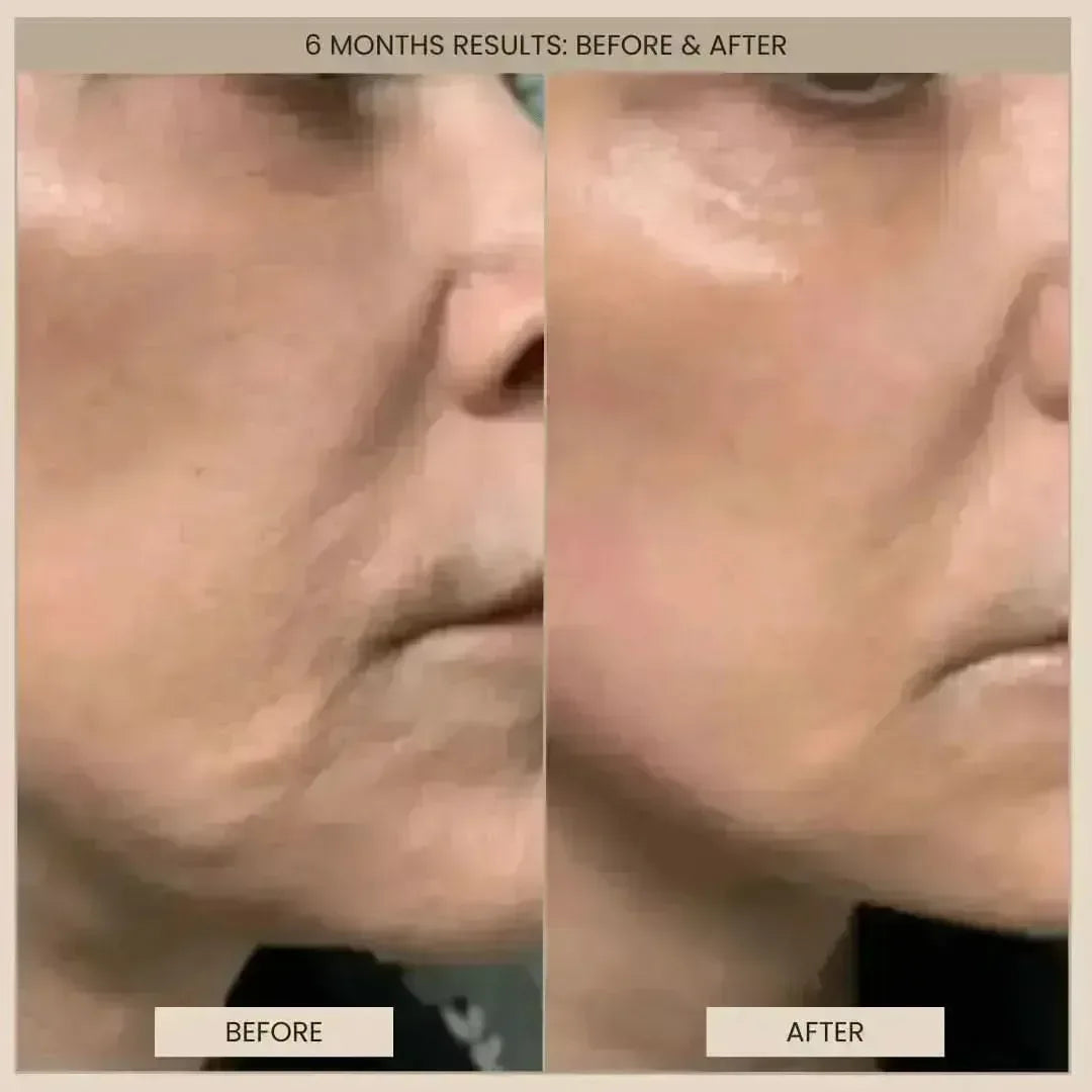 Lumo⁺ + Venus: Comprehensive Anti-Aging Solution for Face and Eyes