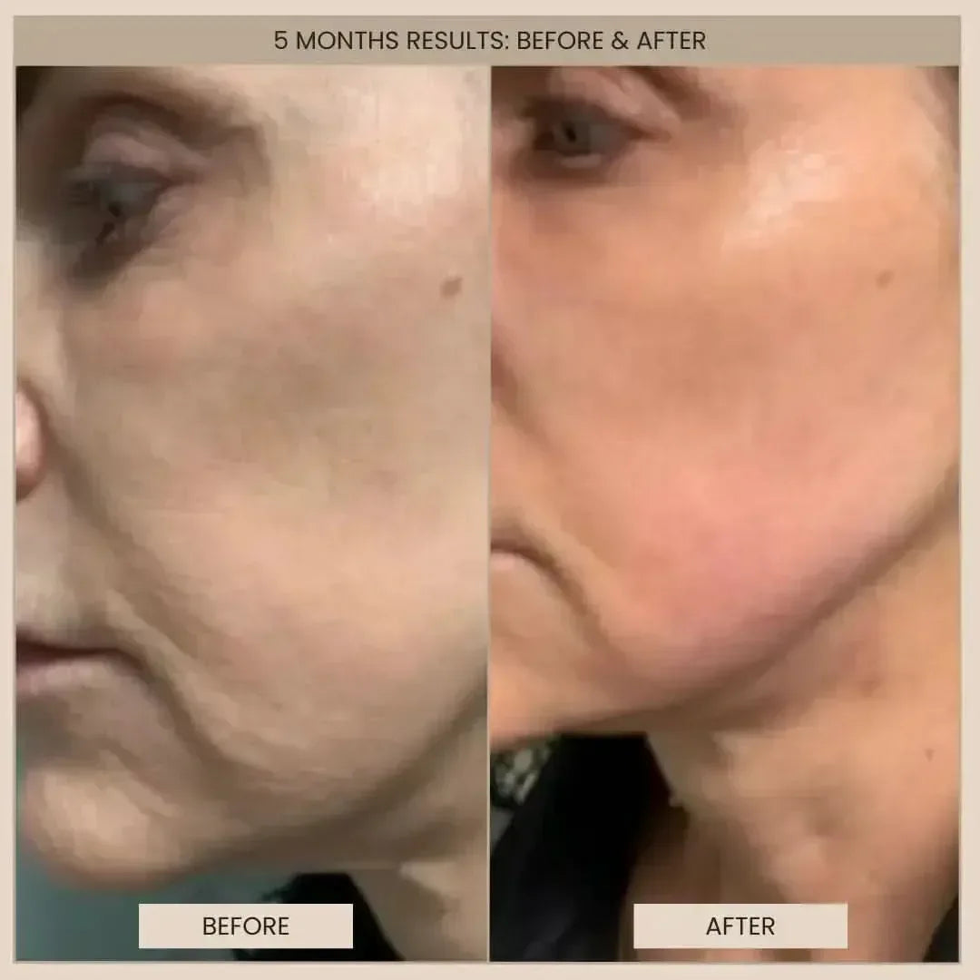EvenSkyn® Lumo⁺: Premium Anti-Aging & Skin Tightening Handset (2026)