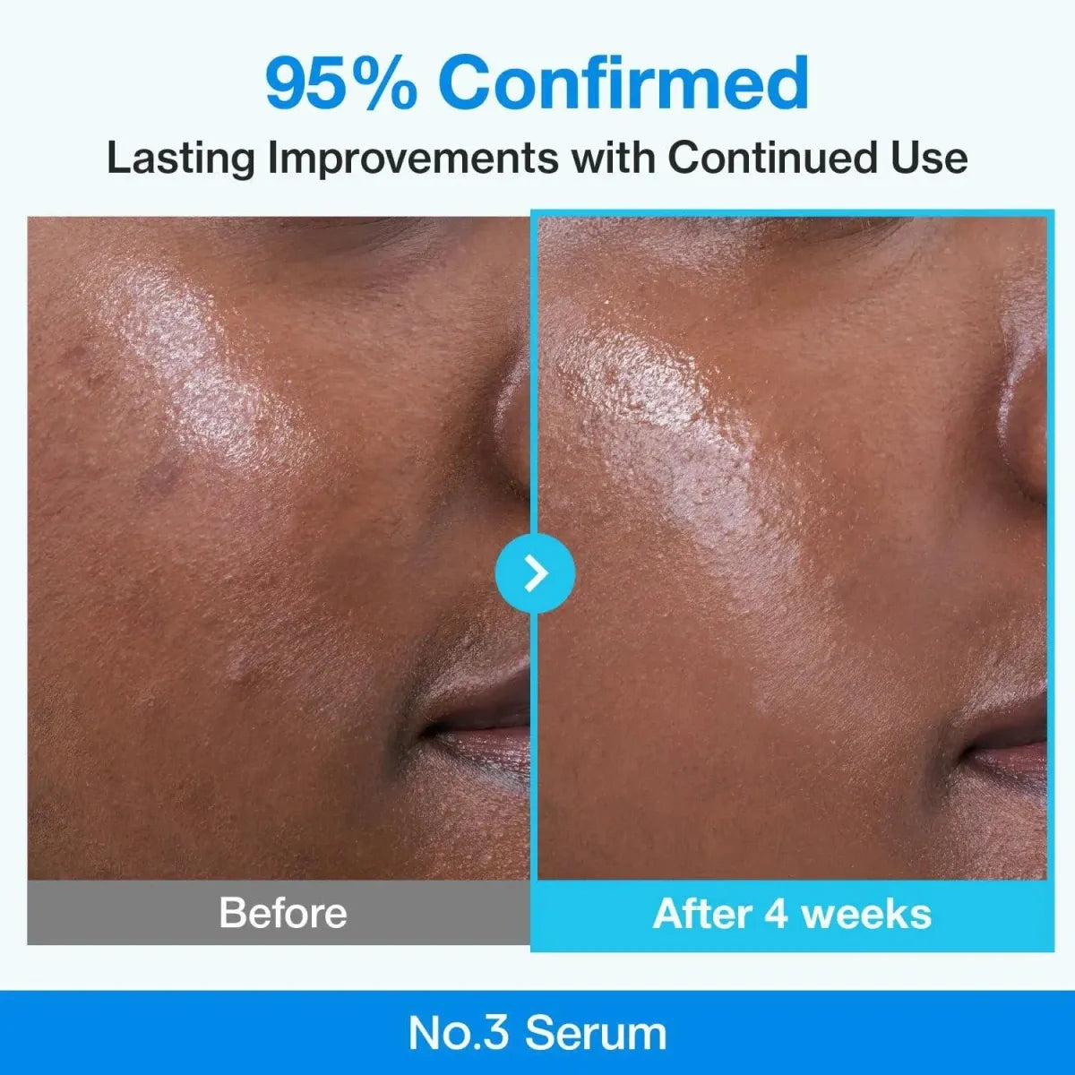 Numbuzin No.3 Blue Bio-Retinol Pore Refining Serum 30ml